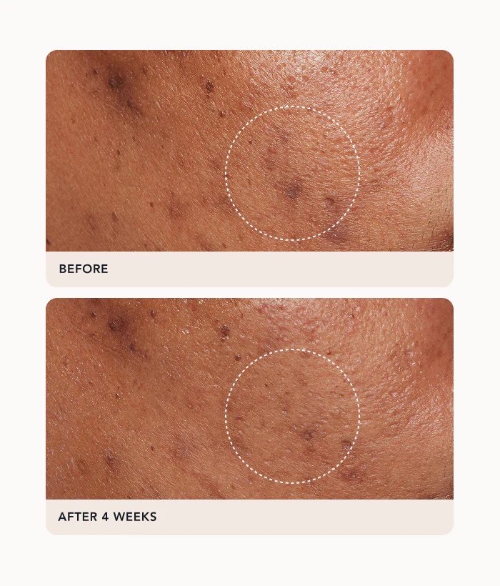 Advanced C Radiance Treatment - Image 4
