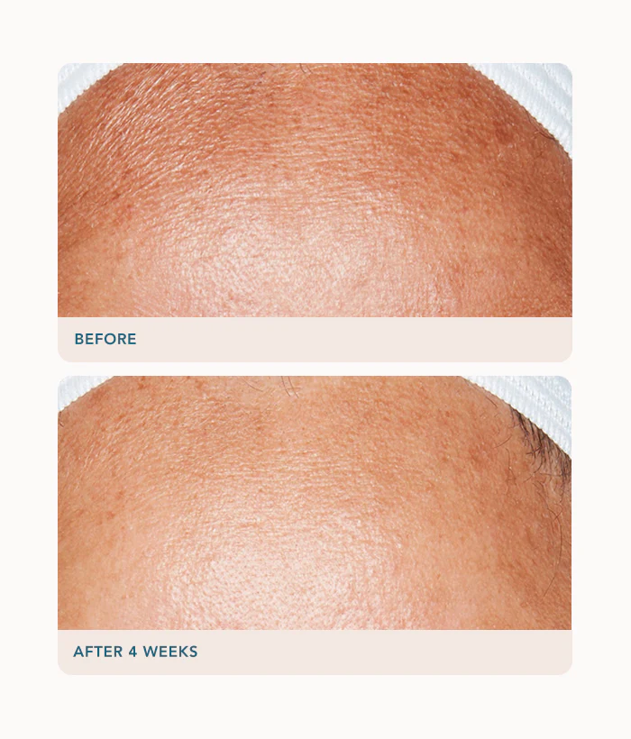 Advanced Retinol Treatment - Image 4