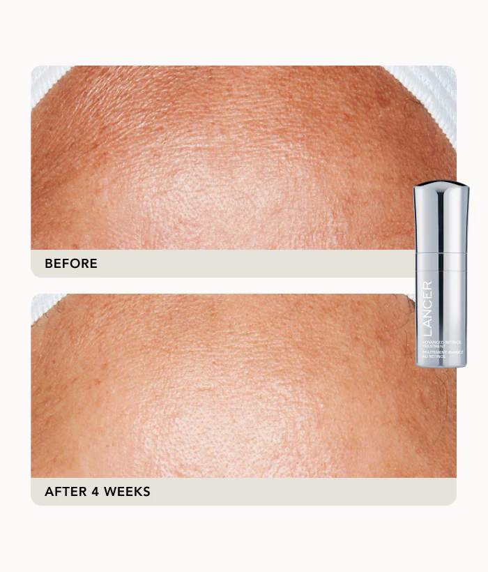 Advanced Treatment Duo - Image 4