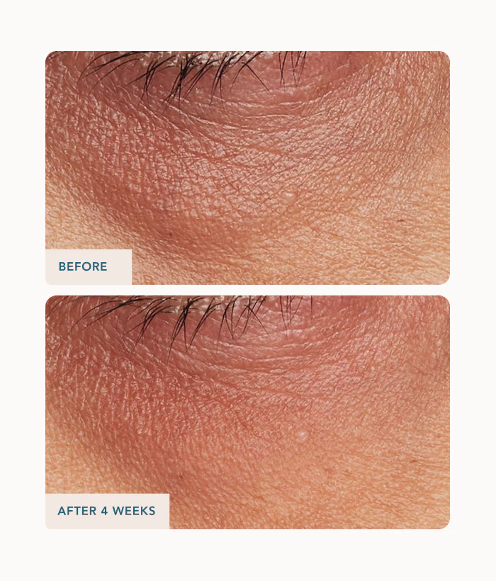 Eye Contour Lifting Cream - Image 4
