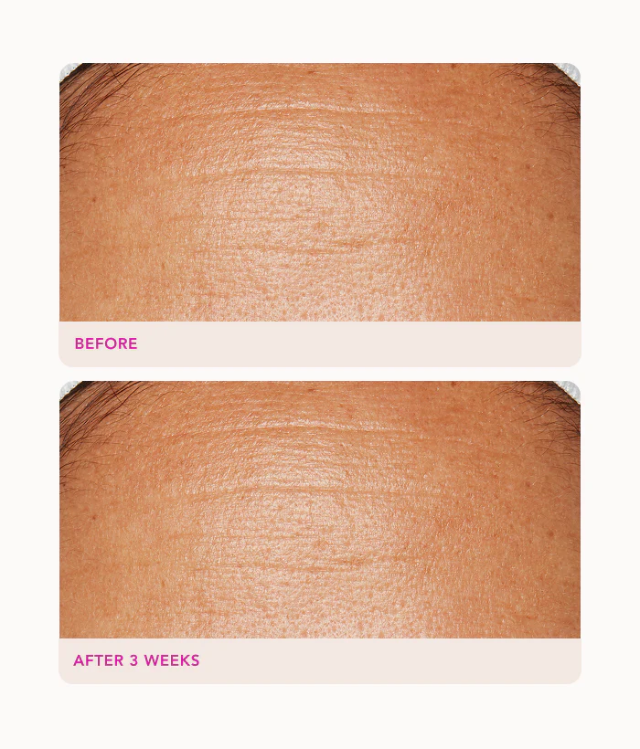 Gentle Exfoliating Peel Pads - Image 4