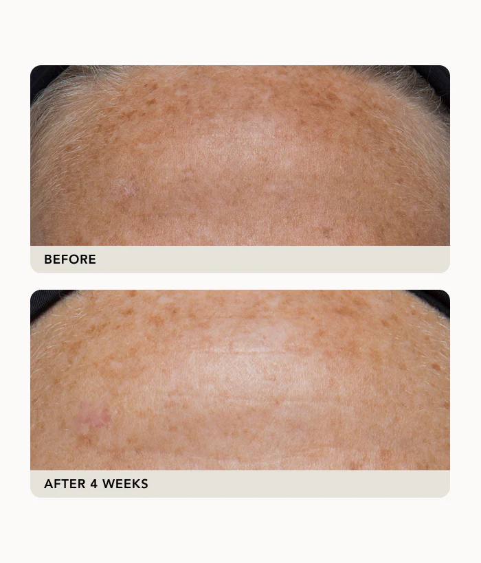 Gravity Dark Spot Correcting Serum - Image 4