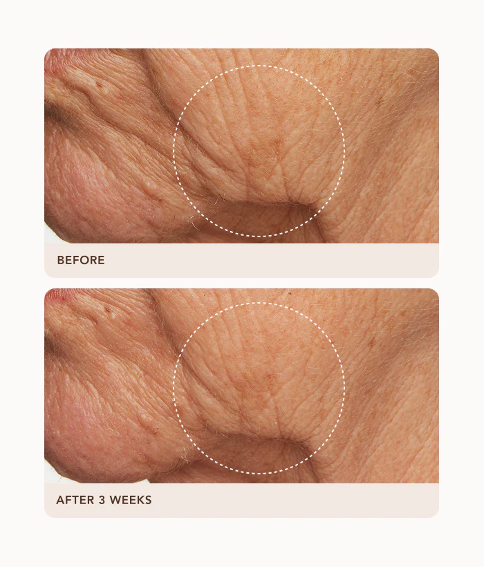 Intensive Night Treatment - Image 4