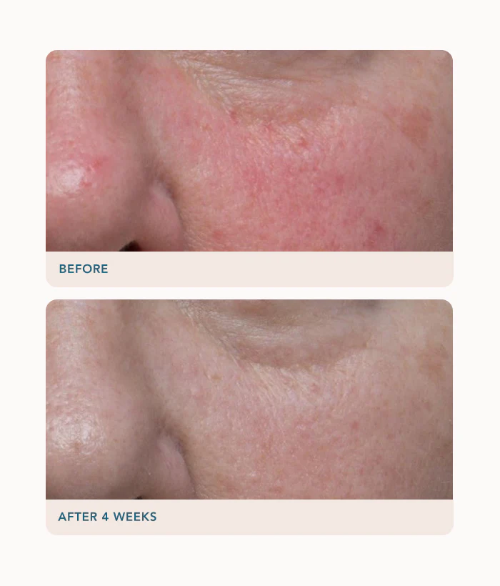 Ultra Rich Barrier Cream - Image 4